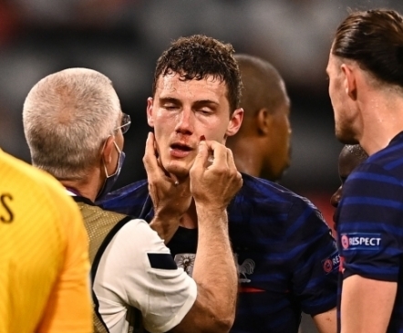 UEFA nõuab prantslastelt aru: miks lasti meelemärkuse kaotanud Pavardil edasi mängida?
