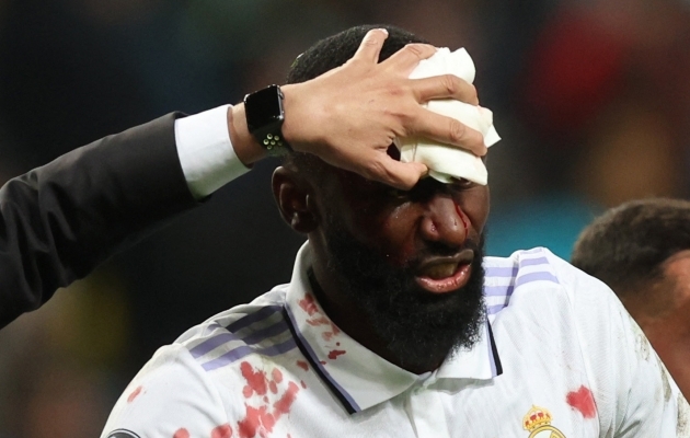 Reali viigivärava löönud Antonio Rüdiger sai seda tehes valusa obaduse vastu pead. Foto: Scanpix / Reuters / Kacper Pempel